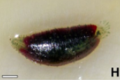 Batracobdelloides conchophylus, a leech of the family Glossiphoniidae