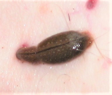 Haemadipsa subagilis, a leech of the family Haemadipsidae