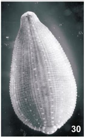 Helobdella cordobensis, a leech of the family Glossiphoniidae