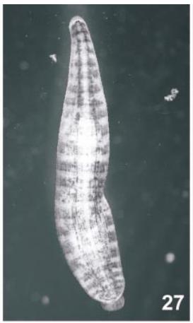 Helobdella duplicata, a leech of the family Glossiphoniidae