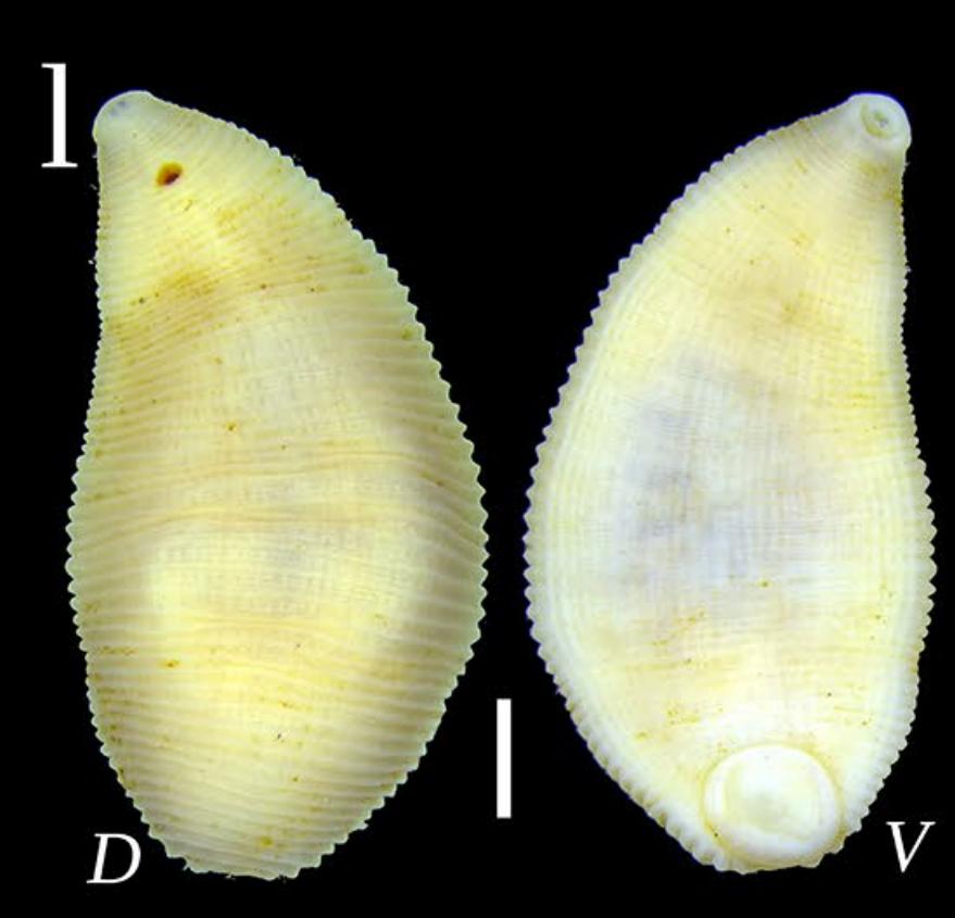 Helobdella okhotica, a leech of the family Glossiphoniidae
