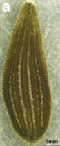 Helobdella robusta, a leech of the family Glossiphoniidae