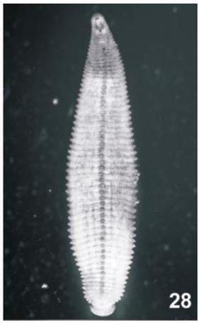 Helobdella simplex, a leech of the family Glossiphoniidae