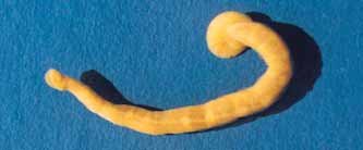 Piscicola milneri, a leech of the family Piscicolidae