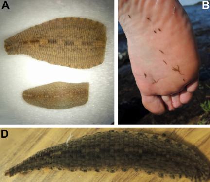 Placobdella rugosa, a leech of the family Glossiphoniidae