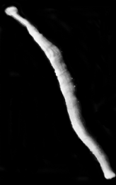 Pleurobdella australis, a leech of the family Piscicolidae