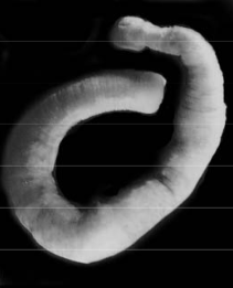 Pleurobdella varituberculata, a leech of the family Piscicolidae
