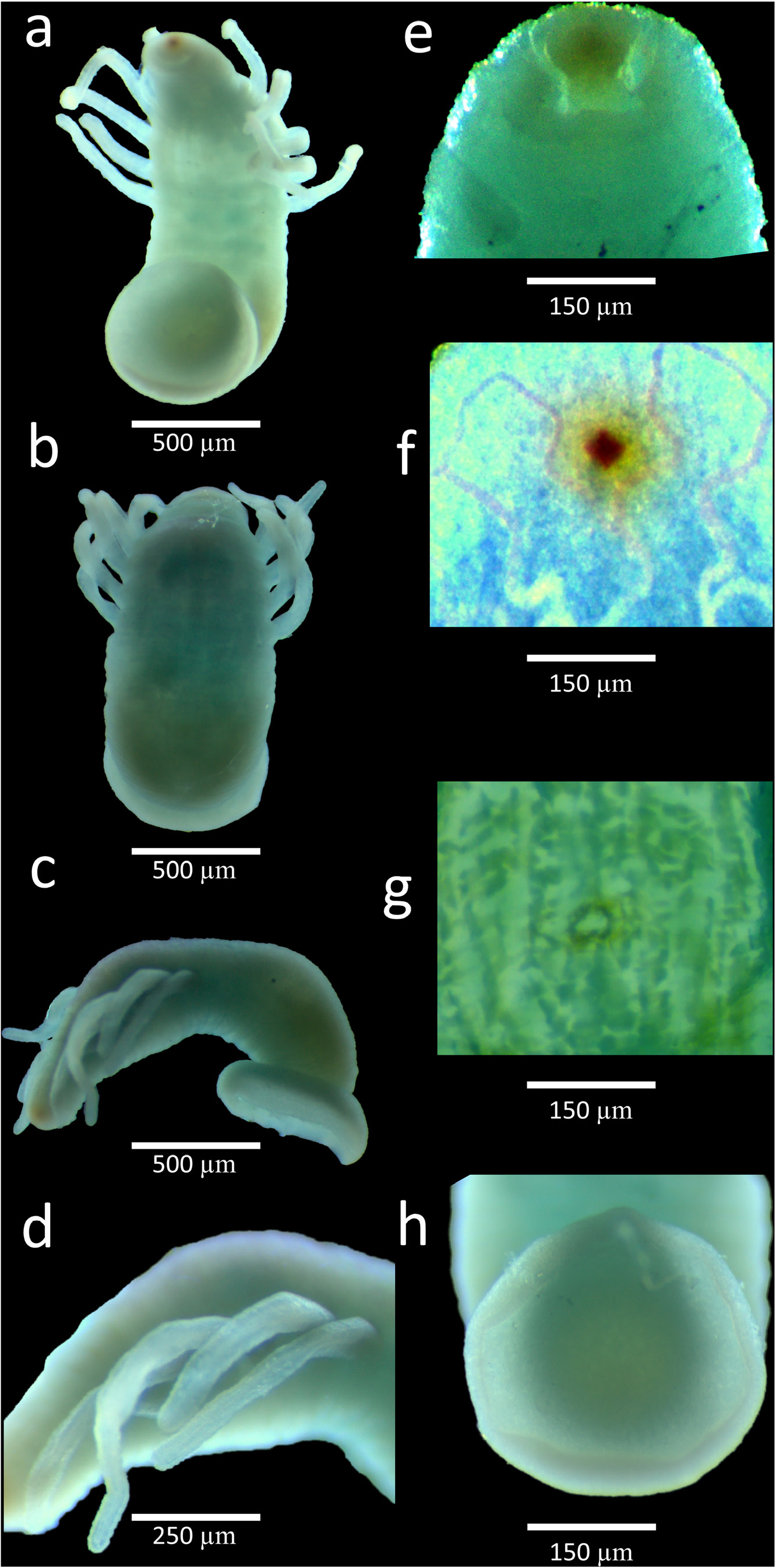 Unoculubranchiobdella expansa, a leech of the family Ozobranchidae
