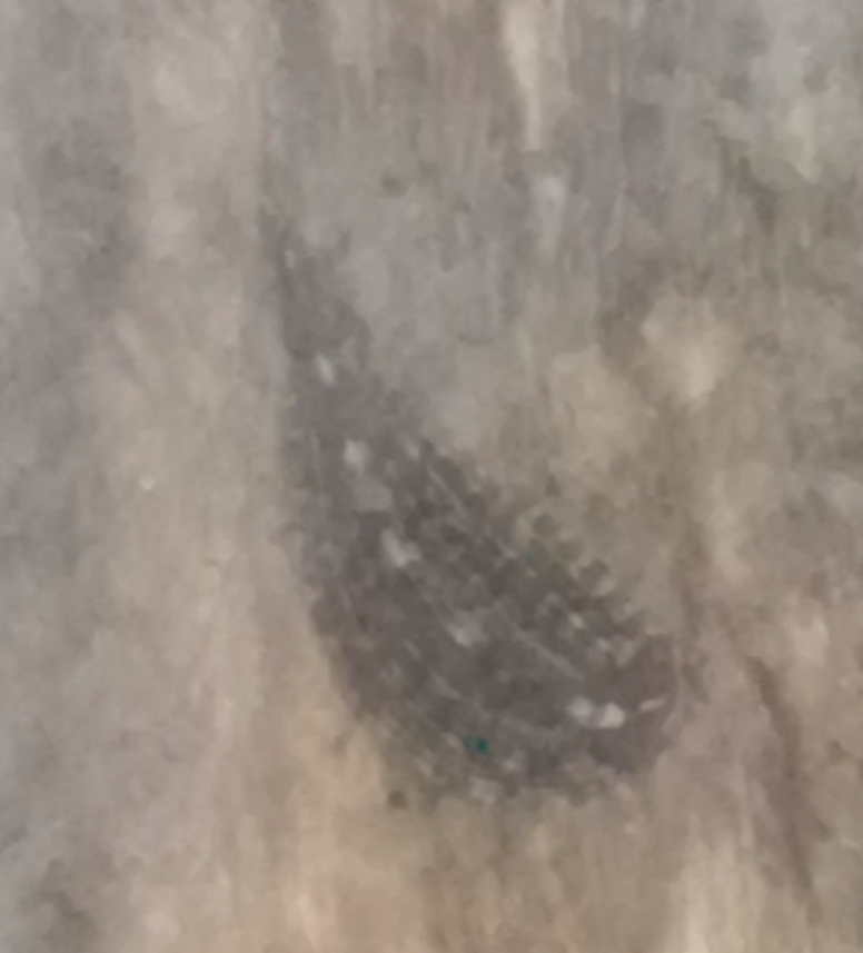 Orientobdelloides sp. 1, an undescribed leech of the family Glossiphoniidae