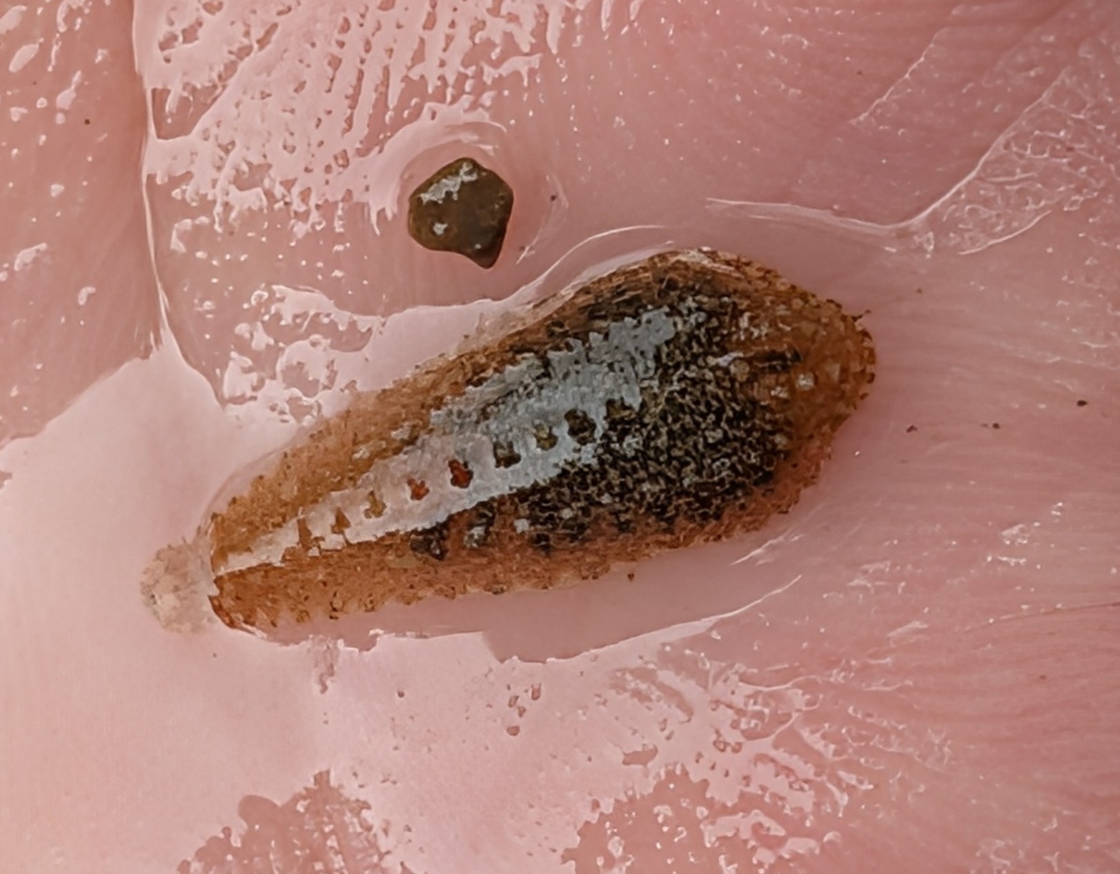 Placobdella sp. 21, an undescribed leech of the family Glossiphoniidae