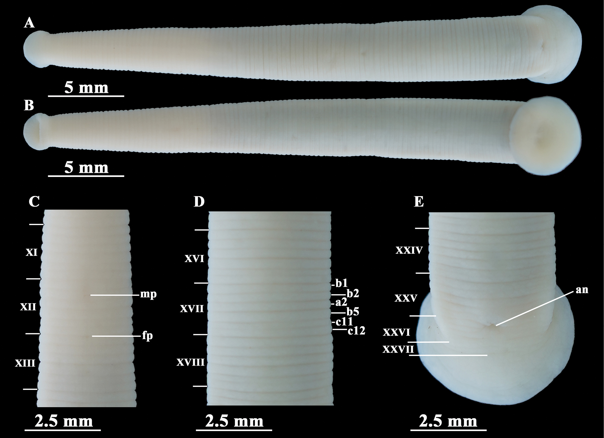 Leech segmentation